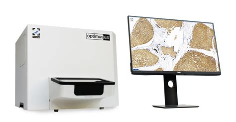 Optimus 6 Slide Scanner Morphle Digital Pathology