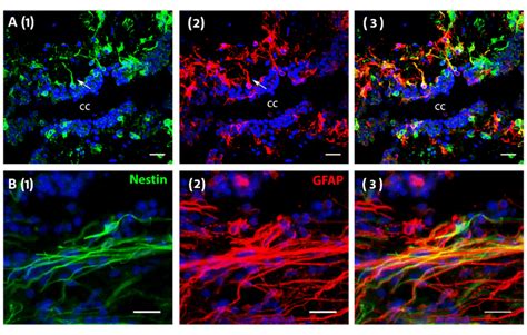 Expression Of Nestin And Gfap In Human Postmortem Tissue Nuclei Are