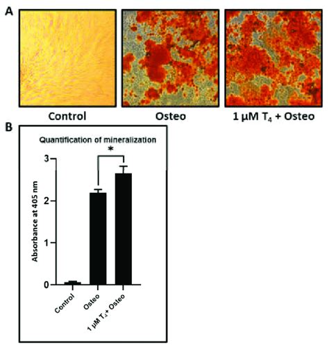 Osteogenic Differentiation Of DPSCs A Differentiated Osteoblasts