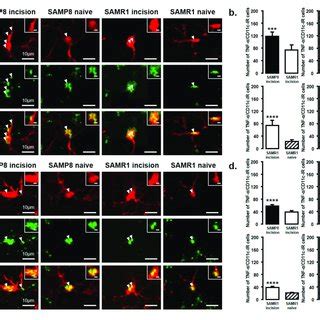 Il Released From M Phenotype Microglia In The Vc And C C Regions