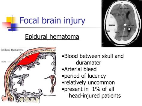 Ppt Head Injury Powerpoint Presentation Free Download Id1451492