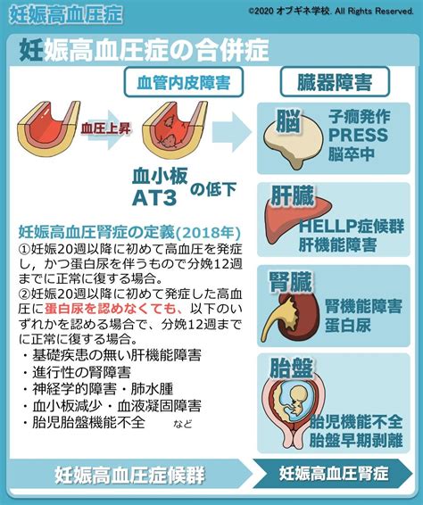 イラストから理解する妊娠高血圧症の基礎│見えてくる産婦人科学 オブギネ学校