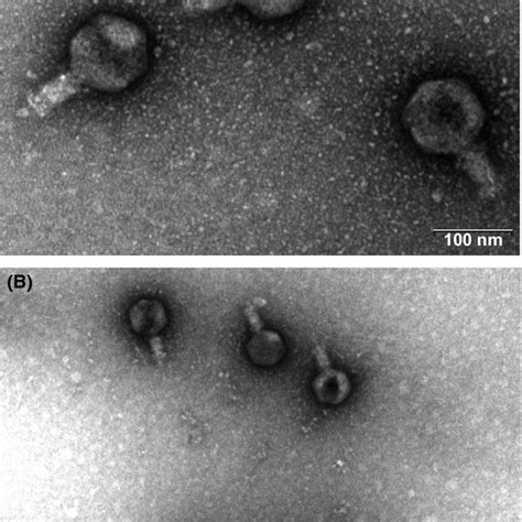 Transmission Electron Microscope Tem Micrographs Of Negatively