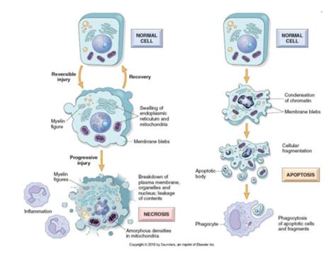 Gen Path Lesson Cell Pathology Flashcards Quizlet