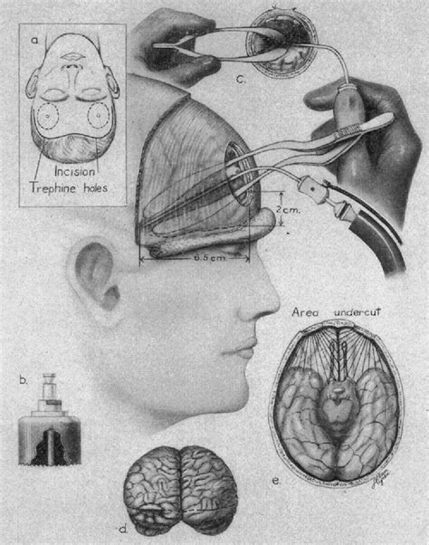 Figure 4 From The Life And Legacy Of William Beecher Scoville