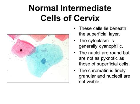 Normal Superficial Squamous Cells Of Cervix Ppt Video Online Download