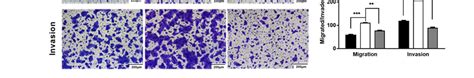 Mir 199a 5p Inhibits Oscc Cell Migration And Invasion Through The