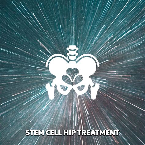 Stem Cell Hip Treatment Dreambody Clinic