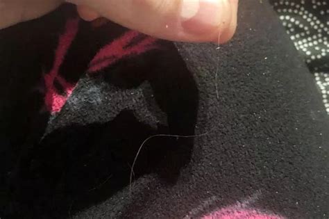 Customer Sickened After Claiming He Found Clump Of Hair In Dominos
