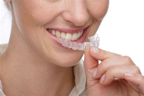 Trattamento Invisalign Cosa Sapere Ciobanu Dentista Milano