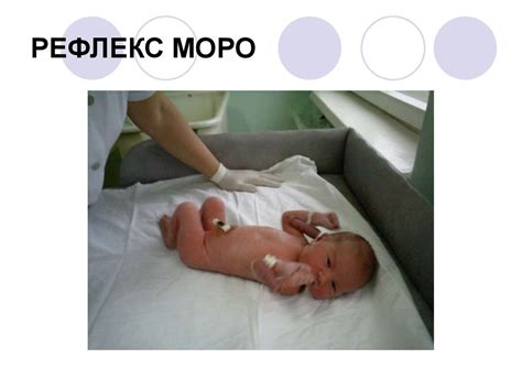 Рефлексы новорожденных - презентация онлайн