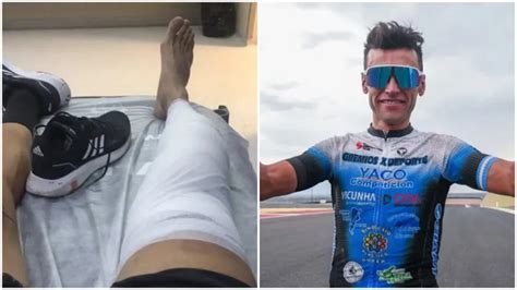 Imagen Impactante Ciclista Sanjuanino Tiene Un Accidente Y La Pierna