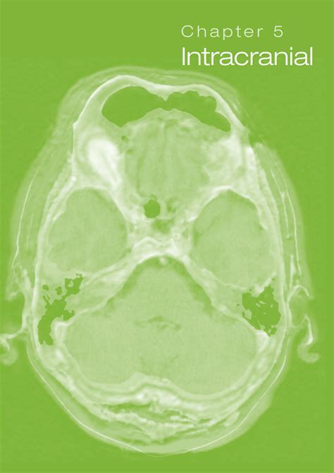 Intracranial Radiology Key