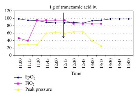 Clinical course: oxygen saturation, FiO2 and peak inspiratory pressure. | Download Scientific ...