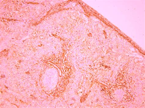 Sma Expression In The Spleen Capsule Sma Immunostaining