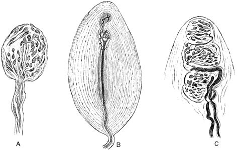 Tactile Corpuscles | ClipArt ETC