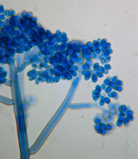 Aspergillus niger LM 1000x Microscopio t Hongos | Plant diseases ...