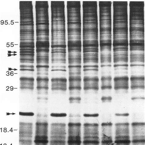 Autoradiogram Of Time Course Showing The Synthesis Of Polypeptides In