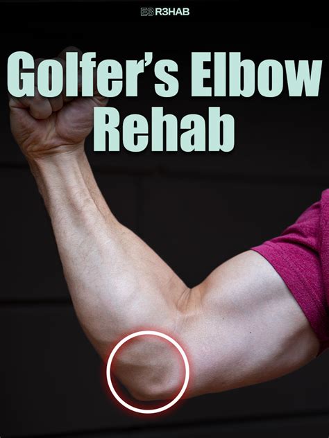 Golfer's Elbow Rehab | Download Free PDF | Anatomical Terms Of Motion ...