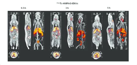 In Vivo SPECT CT Images Of 99m Tc HMPAO ENVs Injected In Mice After