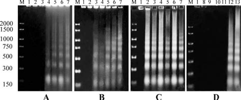 Evidence Of Apoptosis Appearing As A Dna Ladder In Agarose Gel