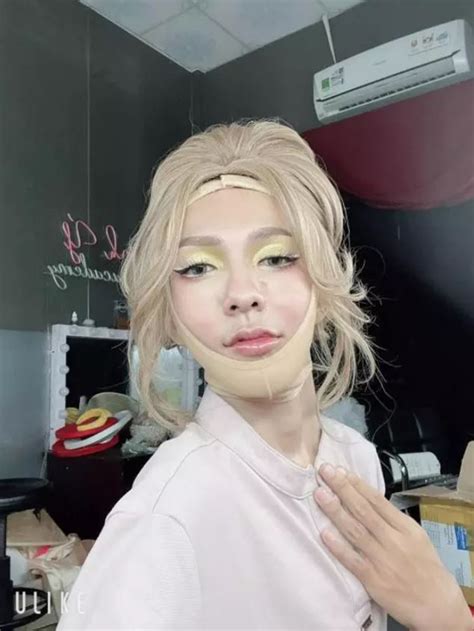 Hot Tiktoker Võ Thành Ý tiết lộ dao kéo diện mạo sau phẫu thuật gây bất ngờ