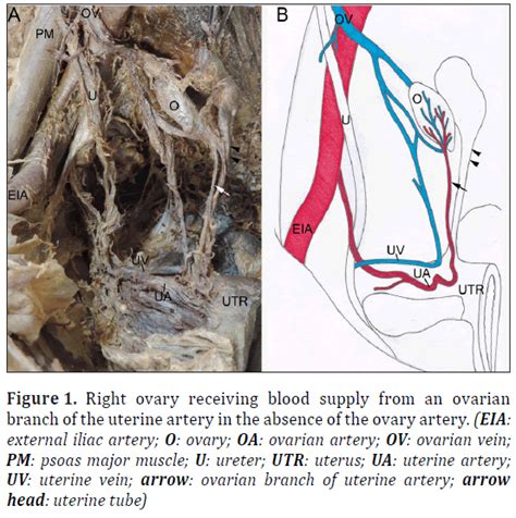 Ovarian Artery Anatomy