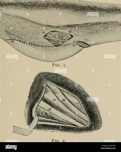 surgical  obstetrical operations   remove  diseasedparts