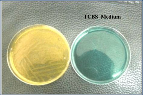 Thiosulfate Citrate Bile Salt Sucrose Tcbs Agar Media Off