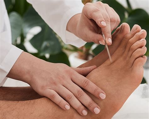 Peripheral Neuropathy Acupuncture Of West Florida