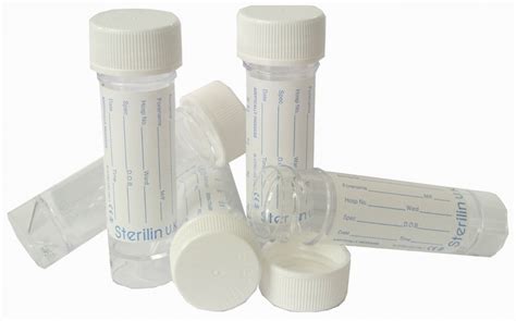 Urine Sample Sterile Containers 30ml Graduated With Screw Cap