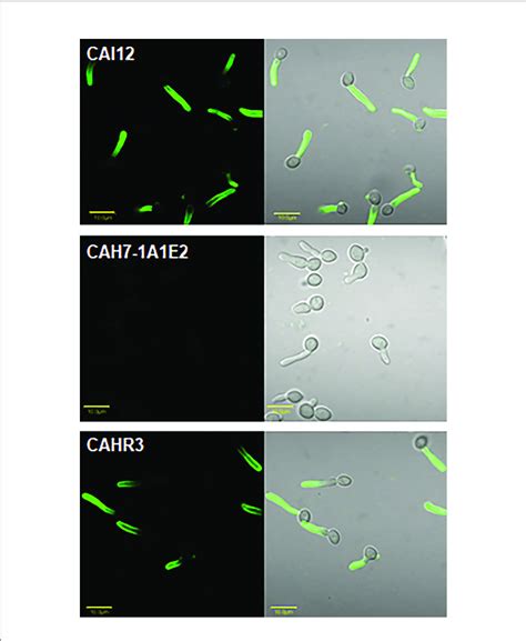 Immunolabeling Of C Albicans Cells To Demonstrate Specificity Of