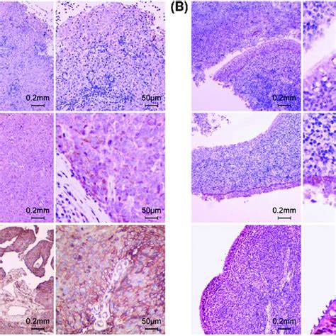 Immunohistochemical Staining Intensity 1 2 3 Of EGFR A