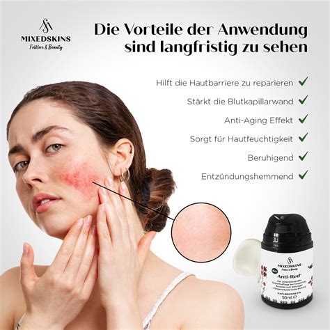 Immunit T F Hrer Chor Rosacea Naturkosmetik Gr Ner Hintergrund