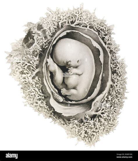 Human embryo at 6 weeks, illustration Stock Photo - Alamy