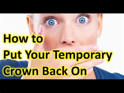 What To Do If My Temporary Crown Fell Off How To Cement Your Crown