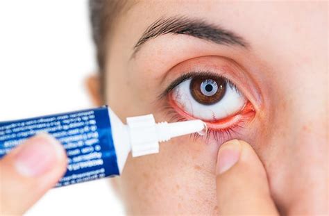 What Is Erythromycin Eye Ointment Ophthalmic