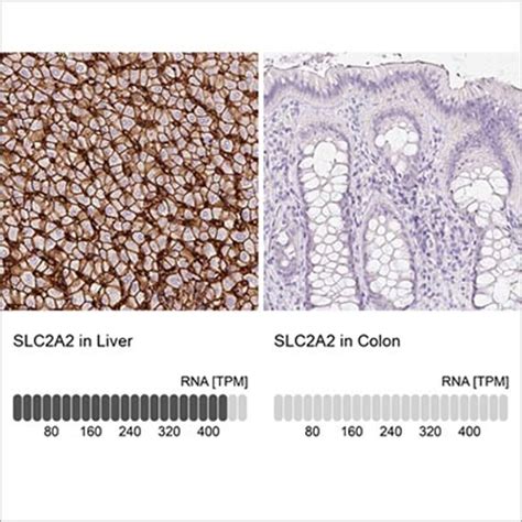 Atlas Antibodies – LubioScience GmbH