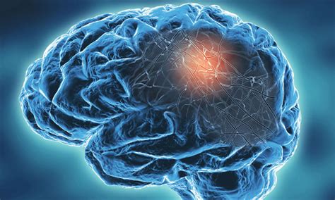 Origins and potential therapies for a neurodegenerative disorder found