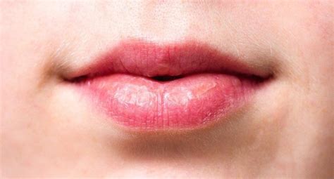 Wrinkles Above the Lips: The Best Treatments & Prevention - GrabNewStyle