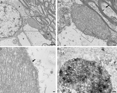 Ultrastructural Aspect Of Murine Tau Filaments Seeded In Vivo By