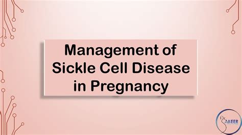 Rcog Guideline Management Of Sickle Cell Disease Youtube