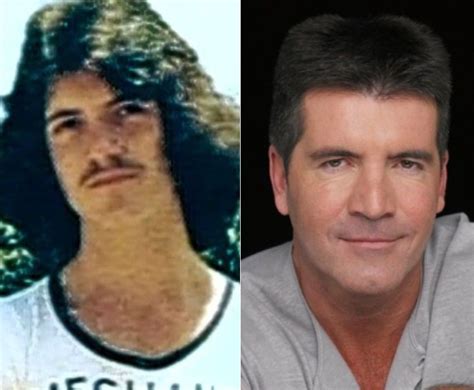 Simon Cowell and plastic surgery