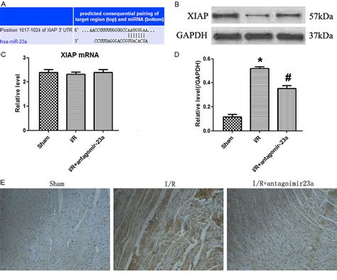 Figure From Mir A Inhibition Attenuates Ischemic Reperfusion