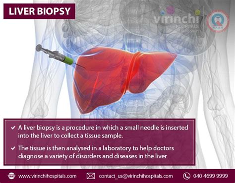 Liver Biopsy Gastroenterology Disease Liver