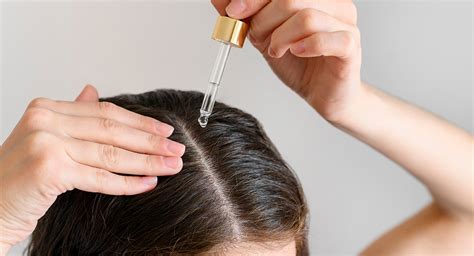 Minoxidil Para Tratamento Da Calv Cie O Minoxidil Um Bom Rem Dio