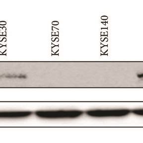 The Expression Level Of Gasc In Escc Cells A Relative Expression Of