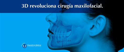 3d Revoluciona Cirugía Maxilofacial Dispositivos Médicos