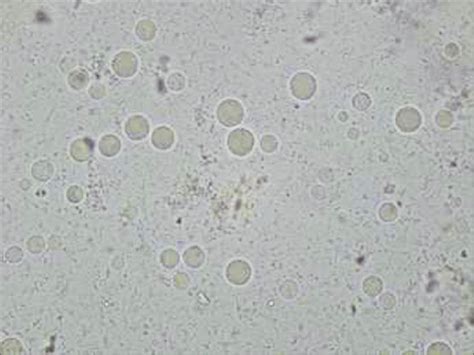 Blastocystis Hominis Cyst