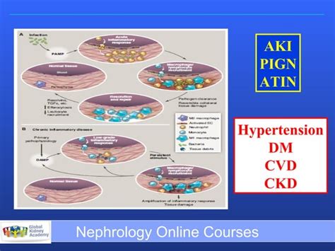 Renal Inflammation and Fibrosis 2013 | PPT